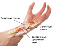    - ortoped-nv.ru - 